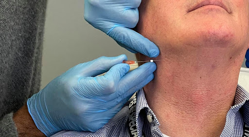 Laser Hair Removal Service «Cosmetic & Laser Medispa at Center For Sight», reviews and photos, 1815 State St, Watertown, NY 13601, USA