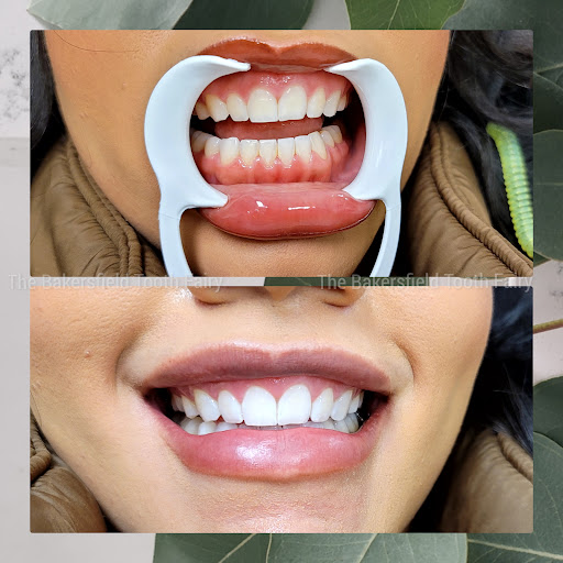 Find octopus tattoo ideas for your next unique tattoo in Bakersfield at Skin Kings Tattoo