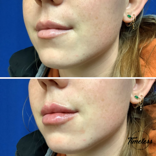 Skin Care Clinic «Timeless Laser & Skin Care», reviews and photos, 29160 Center Ridge Rd, Westlake, OH 44145, USA