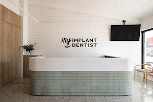 My Implant Dentist South Perth | All-on-4 Dental Implants image