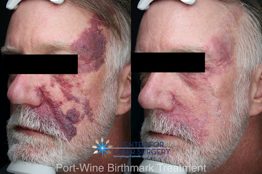 Explore usmc tattoo ideas, creative tattoo ideas in Washington, available at Center For Laser Surgery