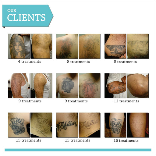 Explore scripture tattoos ideas, creative tattoo ideas in San Jose, available at New Skin Tattoo Removal
