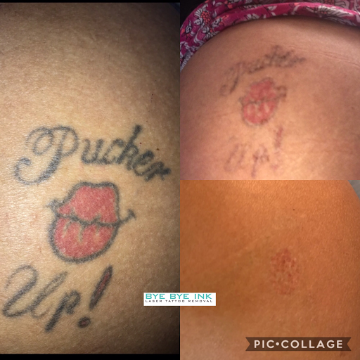 Explore last name tattoo ideas on arm, creative tattoo ideas in Middle Village, available at Bye Bye Ink Laser Tattoo Removal