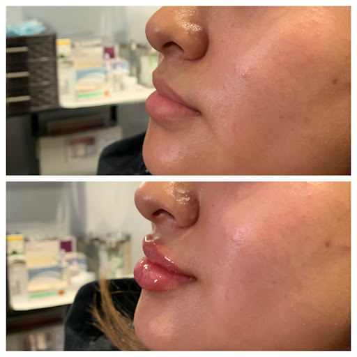 Explore cute animal tattoo ideas, creative tattoo ideas in Portland, available at Oregon Medical & Laser (formerly Cascade Medical & Tattoo Removal)