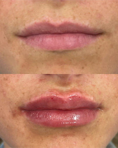 Re-Nu Skin Clinic - Re-Nu Skin Clinic