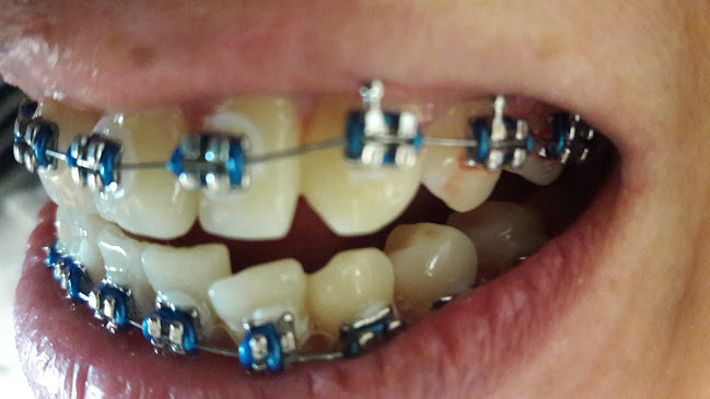 Opiniones de Consultorio Dental Dr David Pslma en Portoviejo - Dentista