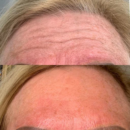 Explore tattoo ideas for triceps, creative tattoo ideas in Owensboro, available at The Skin Lab