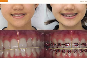 ทำฟัน จัดฟัน เชียงใหม่ M.Square Dental Care - Chiang Mai Dental Esthetic Center image
