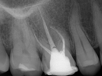 Specialistični Endodontski Zobozdravstveni zavod