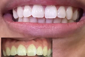 Lavish Cosmetic Teeth Whitening image