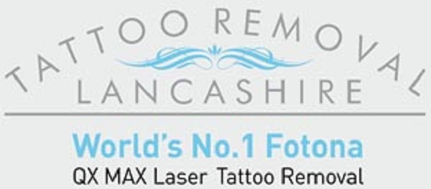 tattoo removal lancashire - Preston