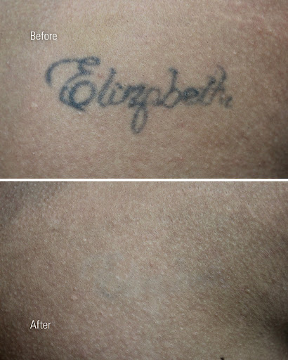 Explore mens family tattoo ideas, creative tattoo ideas in Chandler, available at Removery Tattoo Removal & Fading