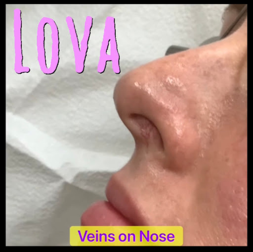 Explore avatar the last airbender tattoos ideas, creative tattoo ideas in Lake Oswego, available at Lake Oswego Vein and Aesthetic LOVA