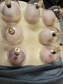 Golden Proportion Acupuncture: Michele Zic-Tuccino LAc - Photo 5 - Car repair in Lyndhurst, NJ, Newark