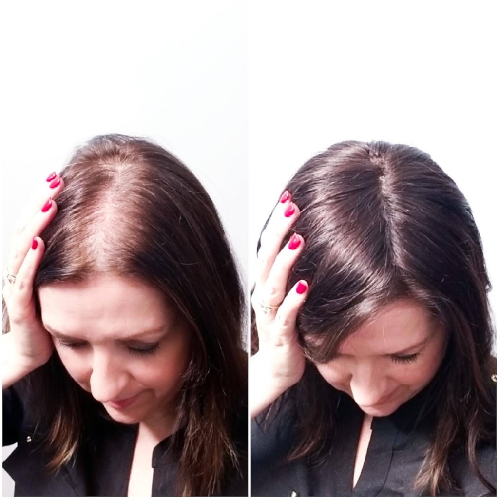 Trichologist | Hair loss | Hair replacement | Wig specialist 55441
