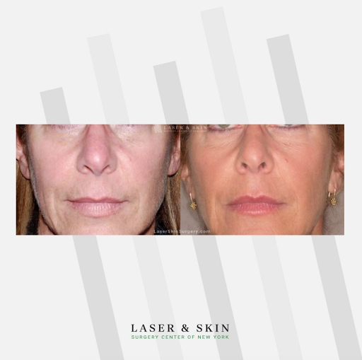 Explore hidden tattoo ideas, creative tattoo ideas in Southampton, available at Laser & Skin Surgery Center of New York - Southampton