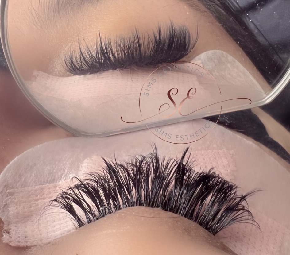 Sims Esthetics 92553