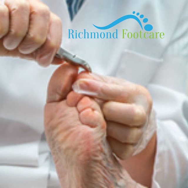 Richmond Footcare