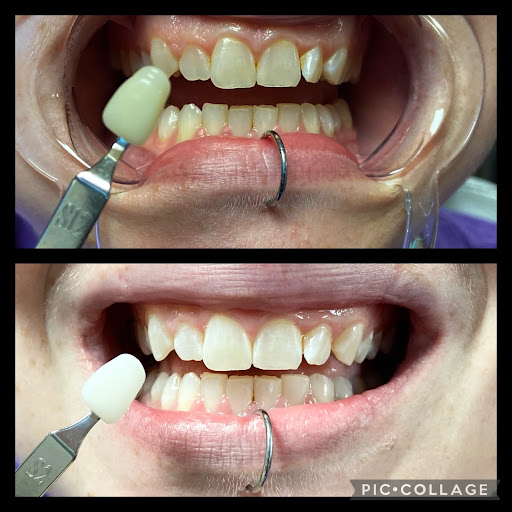 Explore ladies back tattoo ideas, creative tattoo ideas in South Charleston, available at TORQUE Tattoo