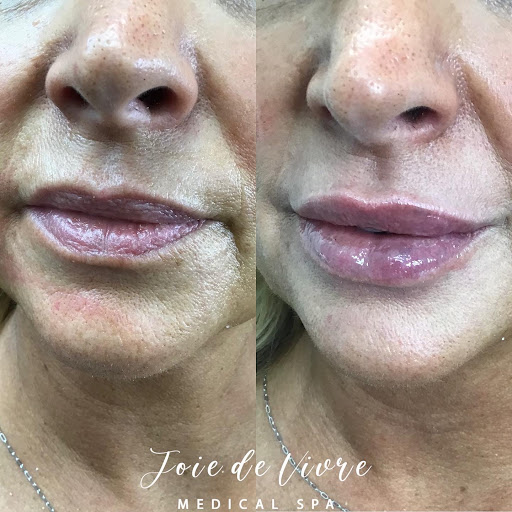 Explore tattoo ideas for survivors of abuse, creative tattoo ideas in Canton, available at JDV Med Spa