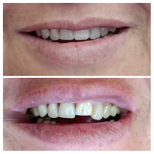 Dental Lincoyan 15 - Dentista