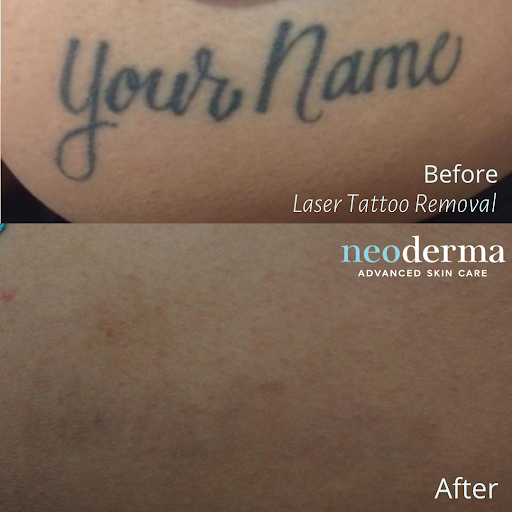 Explore yin yang couple tattoo ideas, creative tattoo ideas in Anaheim, available at Neoderma