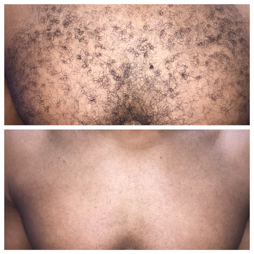 Explore deceased mom tattoo ideas, creative tattoo ideas in Raleigh, available at ExcelLase