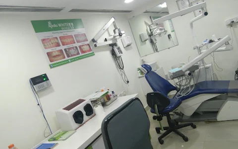 Apollo Dental Clinic – Best Dentist in Somajiguda Hyderabad - Dental Implants, Aligners, Oral Surgery, Teeth Whitening & RCT image