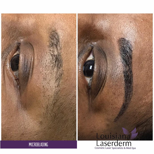 Explore pantera tattoo ideas, creative tattoo ideas in Baton Rouge, available at Louisiana Laserderm