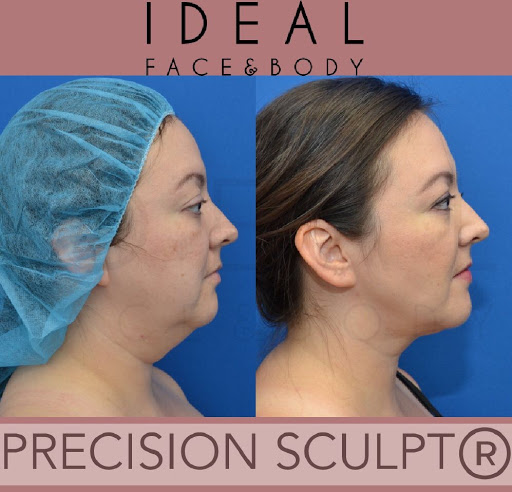 Ideal Face & Body image