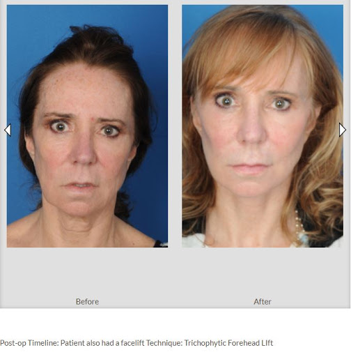 The Larrabee Center for Plastic Surgery