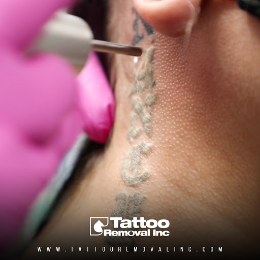Explore small colourful tattoo ideas, creative tattoo ideas in South Gate, available at Tattoo Removal Inc