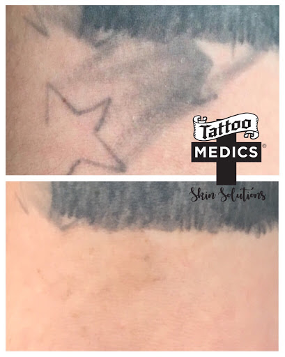 Explore street sign tattoo ideas, creative tattoo ideas in Providence, available at TattooMedics Laser Tattoo Removal