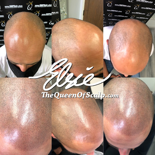 SMP Hair Clinic The Queen Of Scalp image