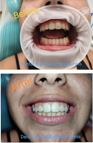 Αξιολογήσεις για το Οδοντιατρείο Καλαντζής Ιωάννης στην Ηρακλείδες - Οδοντίατρος