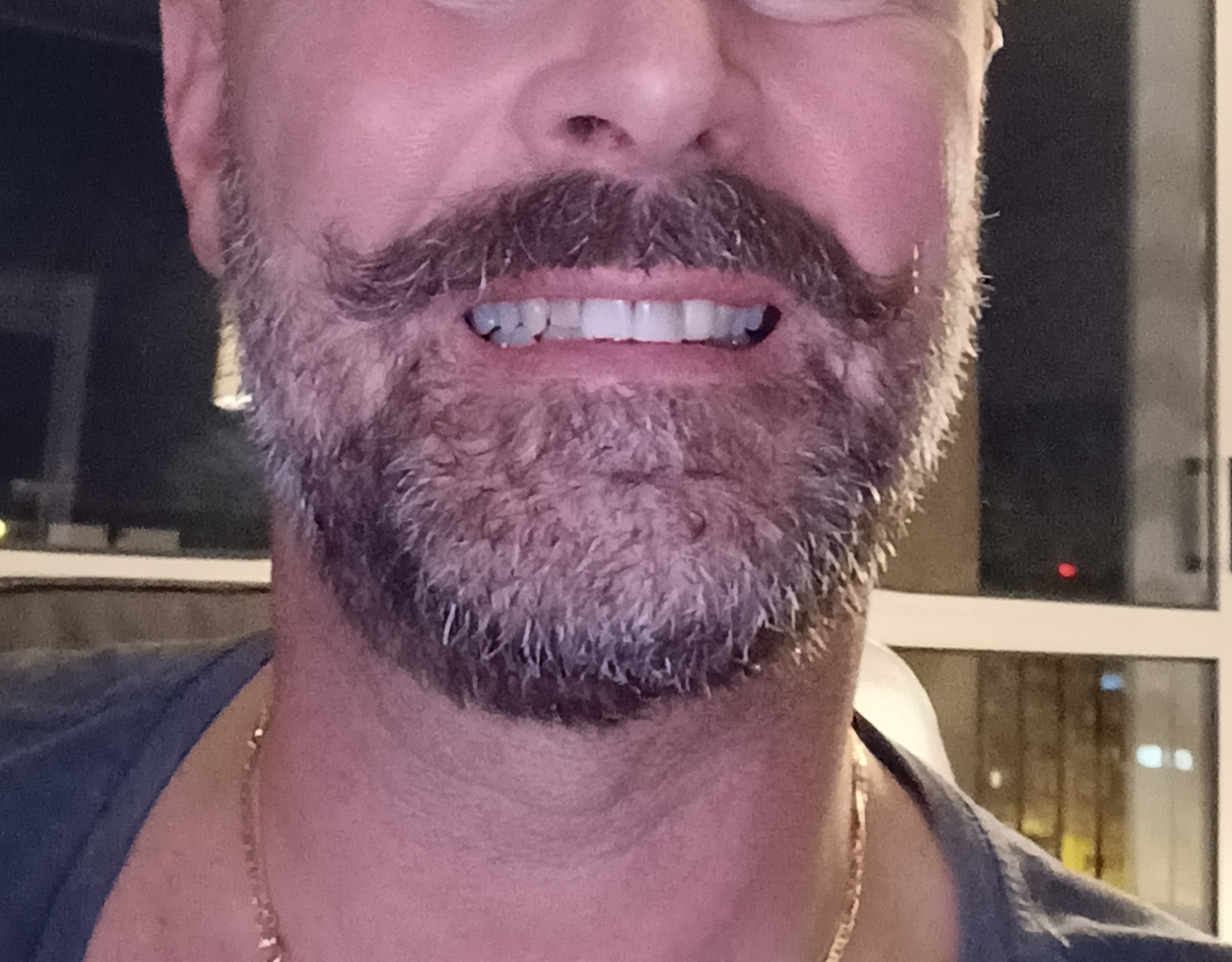 Photo n° 1 de l'avis de Fred.a fait le 26/11/2022 à 17:23