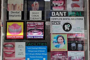 DANT HEAL(Complete Dental Solutions),Best Dental Clinic,Dr.Rohit Gupta. image
