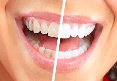 Dr David Azria - Dentiste Paris 19 - Facettes dentaires - Implant et prothèse dentaire - Invisalign - Parodontie