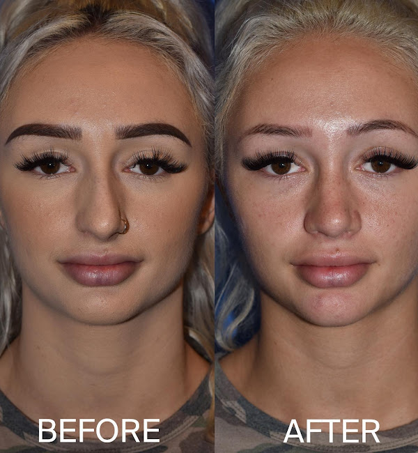 best facial plastic surgeon