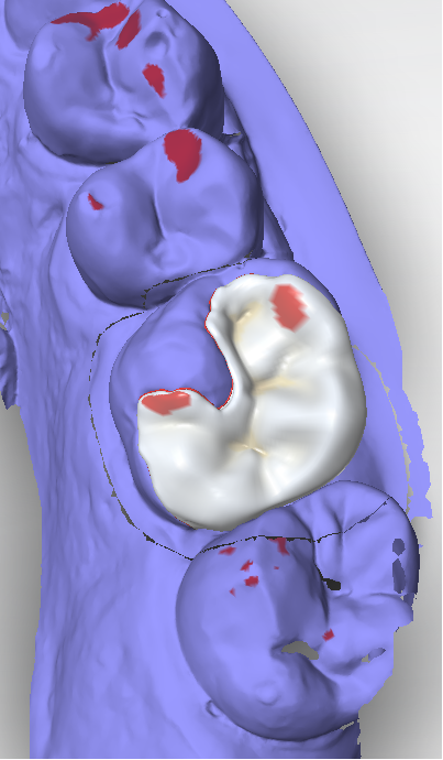 Procad Diseño Dental
