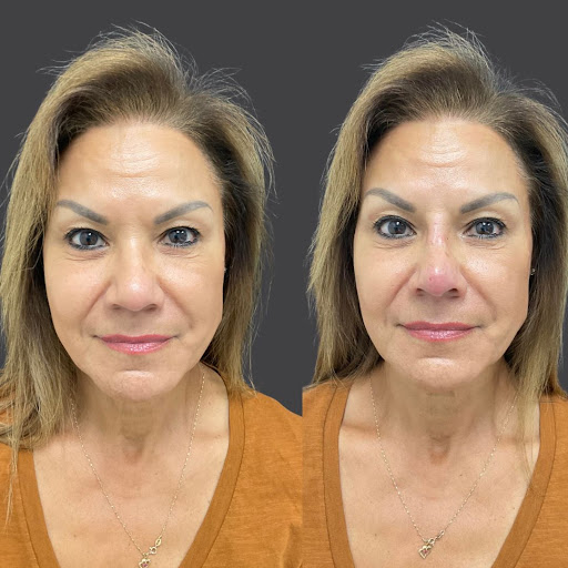 Explore full moon tattoo ideas, creative tattoo ideas in Whittier, available at Skin Perfect Medical Aesthetics