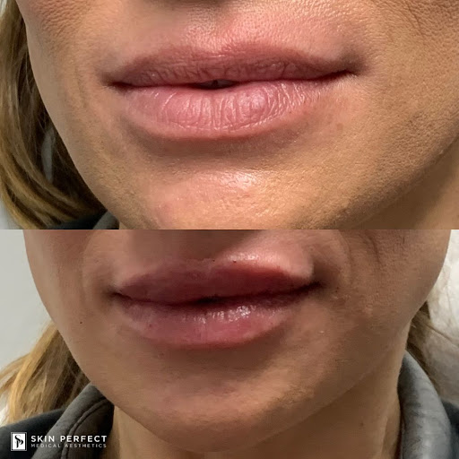 Explore lone wolf tattoo ideas, creative tattoo ideas in Whittier, available at Skin Perfect Medical Aesthetics