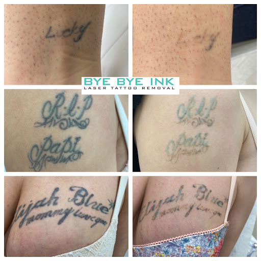 Explore step brothers tattoo ideas, creative tattoo ideas in Middle Village, available at Bye Bye Ink Laser Tattoo Removal