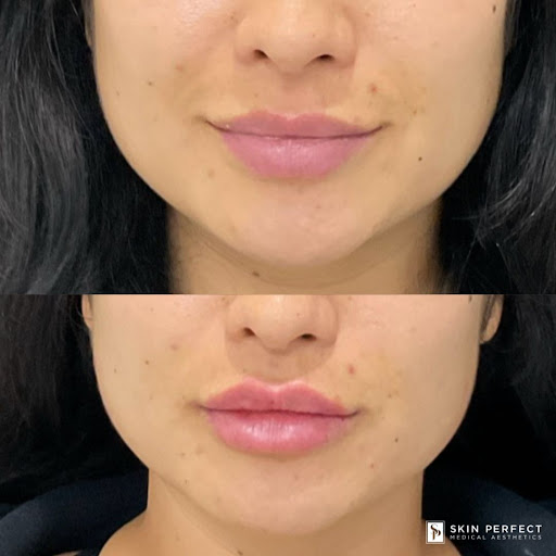 Explore gangster tattoo ideas for men, creative tattoo ideas in Whittier, available at Skin Perfect Medical Aesthetics