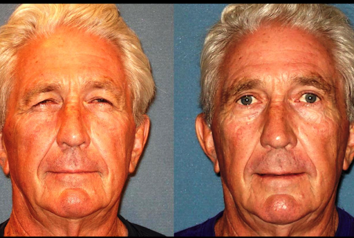 Plastic Surgeon «Arizona Eye Institute & Cosmetic Laser Center», reviews and photos, 19052 N R H Johnson Blvd, Sun City West, AZ 85375, USA