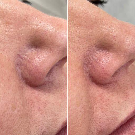 Explore small dragonfly tattoo ideas, creative tattoo ideas in Owensboro, available at The Skin Lab