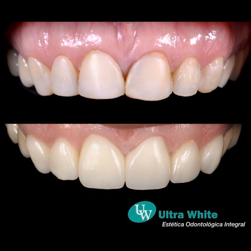 Ultra White Estética Odontológica