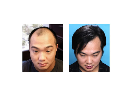 Hair Transplantation Clinic «Bosley Medical - Dallas», reviews and photos, 5949 Sherry Ln #1150, Dallas, TX 75225, USA