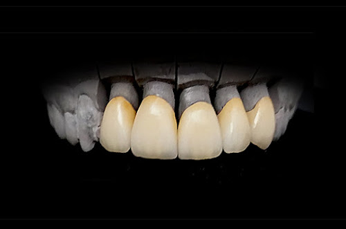 Centre de prothèses dentaires BD Prothèses Romeries