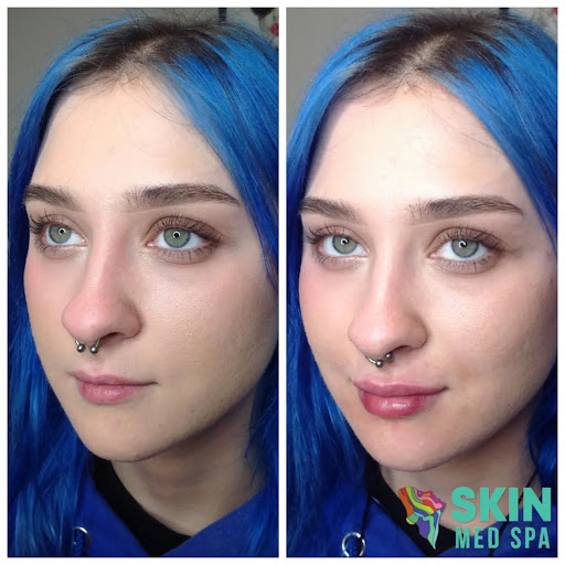 Explore lily tattoo ideas, creative tattoo ideas in Downers Grove, available at Skin Med Spa